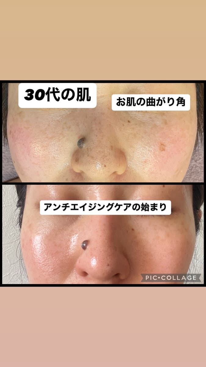 30代の肌の変化を紹介する Instagram 投稿