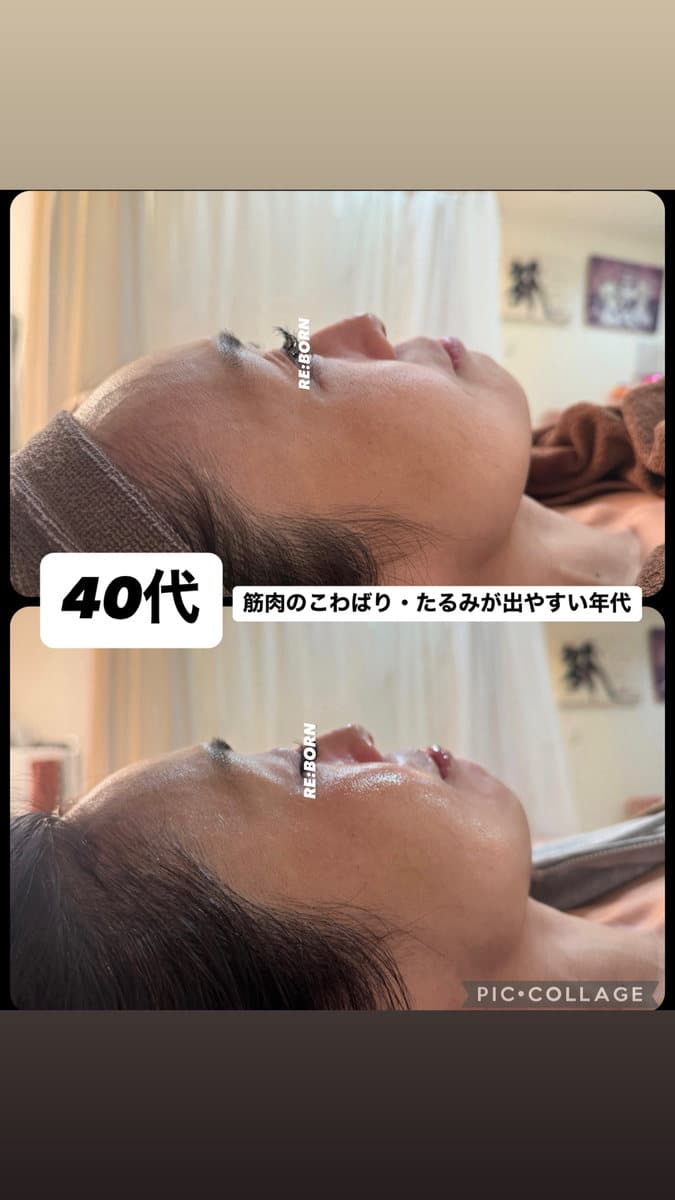 40代の肌の変化を紹介する Instagram 投稿