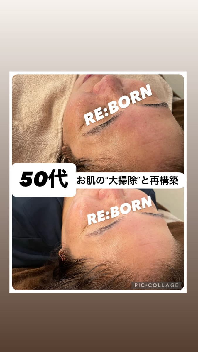 50代の肌の変化を紹介する Instagram 投稿